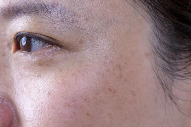 在雪场被晒得很曼妙AG真人不知道我(图3) 在雪场被晒得很曼妙AG真人不知道我(图3)